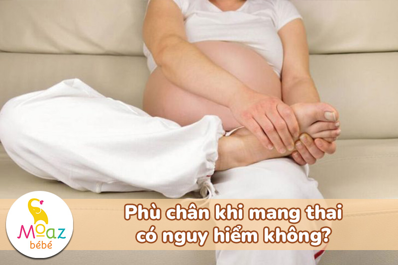Phù chân khi mang thai có nguy hiểm không?