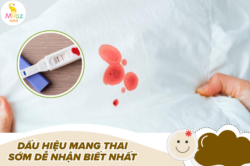 Một số dấu hiệu mang thai sớm dễ nhận biết nhất