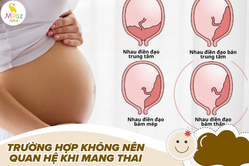 Có nên quan hệ khi mang thai không? Một số lưu ý đảm bảo an toàn 7 Những trường hợp nào không nên quan hệ khi mang thai?