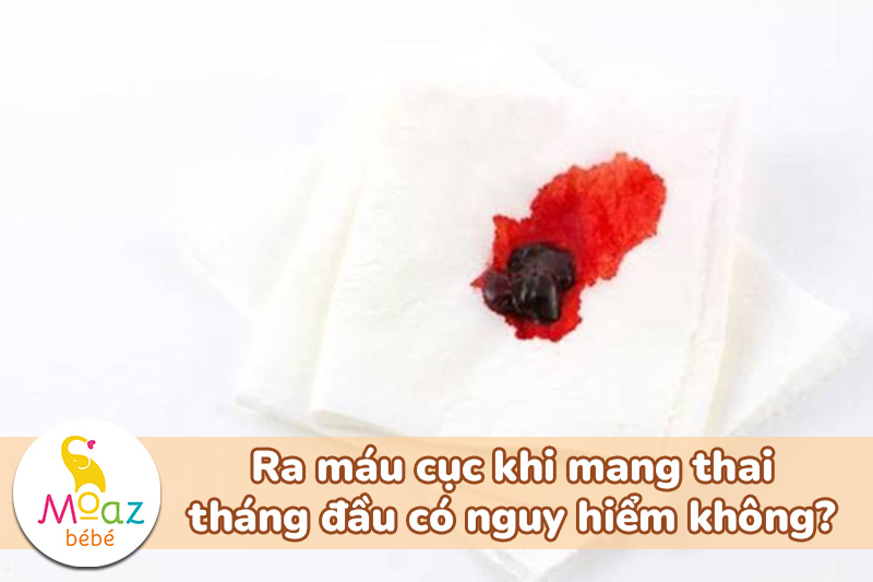 Ra máu cục khi mang thai tháng đầu có nguy hiểm không?