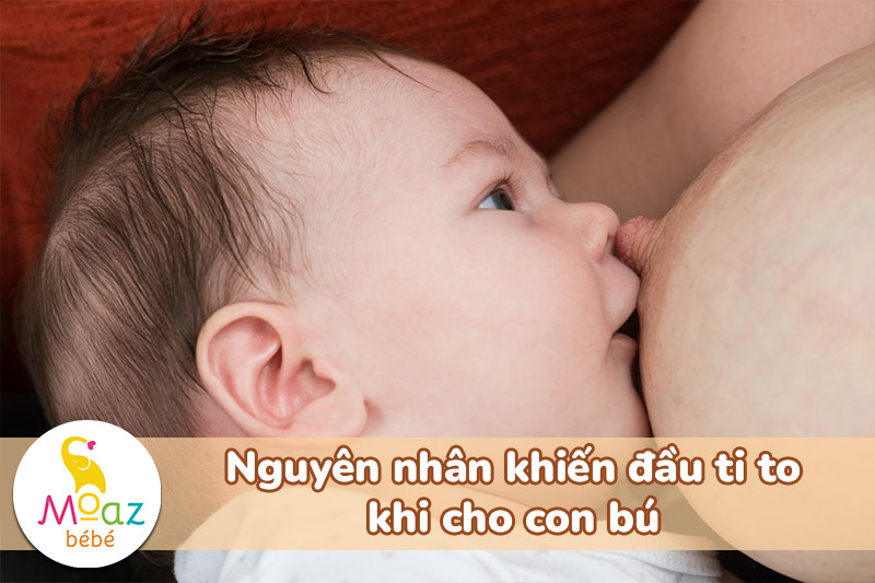 Nguyên nhân khiến đầu ti to khi cho con bú