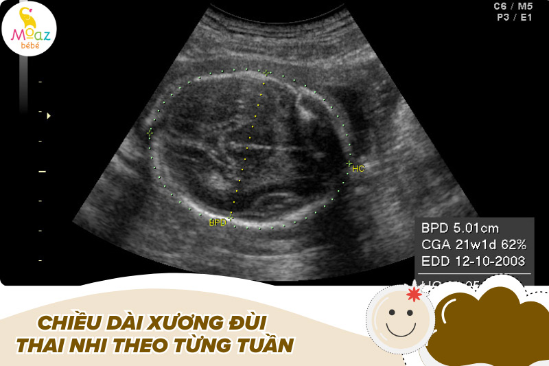 Bảng chiều dài xương đùi thai nhi theo từng tuần