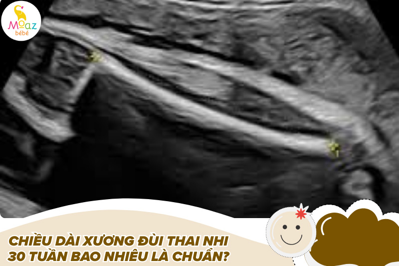 Chiều dài xương đùi thai nhi 30 tuần bao nhiêu là chuẩn?