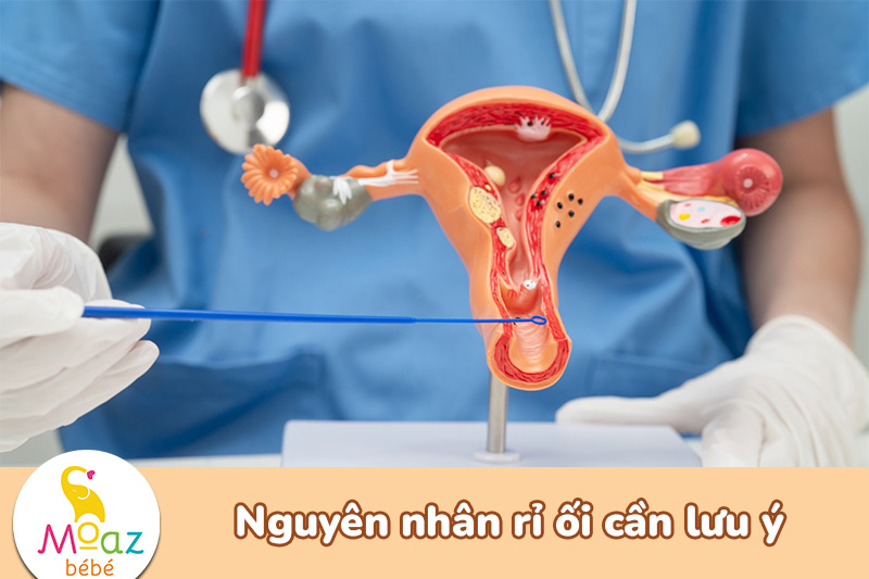 Cách nhận biết dấu hiệu rỉ ối dễ nhận biết cho mẹ bầu 5 Nguyên nhân rỉ ối mẹ bầu cần lưu ý