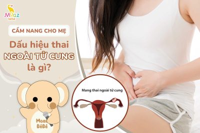 Dấu hiệu thai ngoài tử cung là gì?