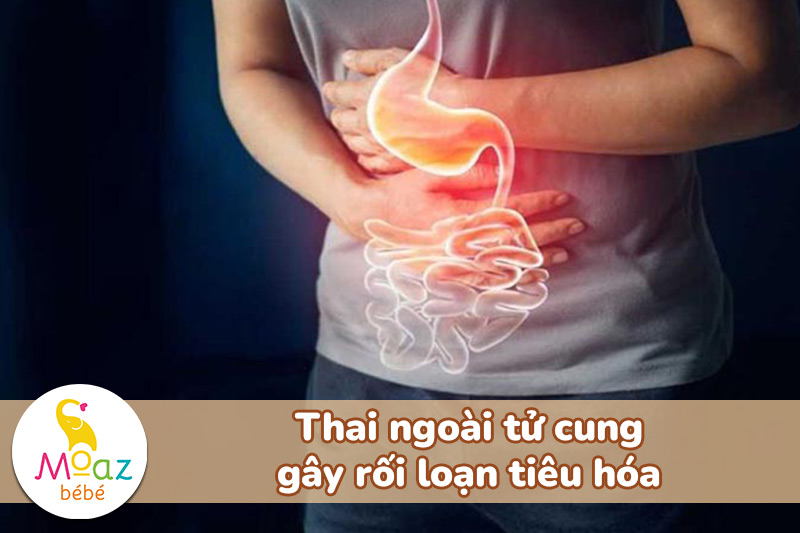 Thai ngoài tử cung gây rối loạn tiêu hóa