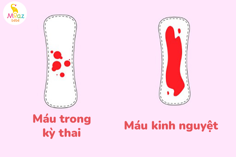 Mang thai có kinh nguyệt không? Sự thật nhiều người nhầm lẫn 5 Phân biệt máu kinh nguyệt và máu trong kỳ mang thai