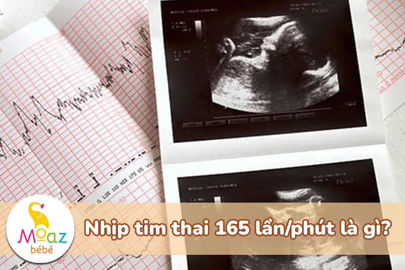 Nhịp tim thai 165 lần/phút là trai hay gái? Cách đoán giới tính qua nhịp tim thai 1 Nhịp tim thai 165 lầnphút là gì
