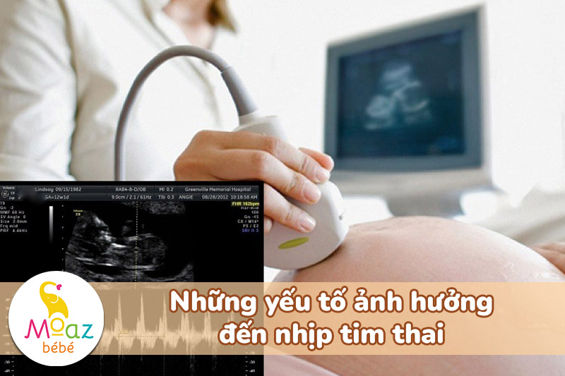 Nhịp tim thai 165 lần/phút là trai hay gái? Cách đoán giới tính qua nhịp tim thai 3 Những yếu tố ảnh hưởng đến nhịp tim thai