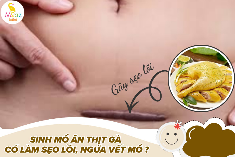 Sinh mổ ăn thịt gà có làm sẹo lồi