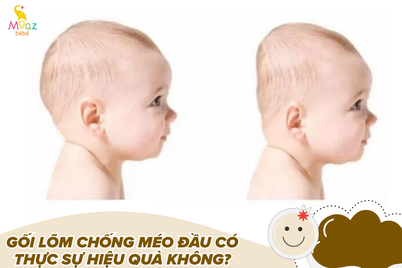 Gối lõm chống méo đầu có thực sự hiệu quả không?