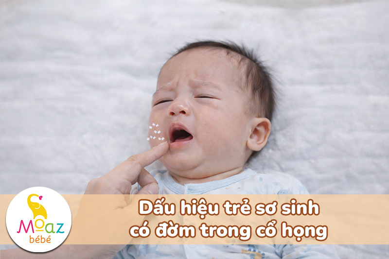 hút đờm cho trẻ sơ sinh