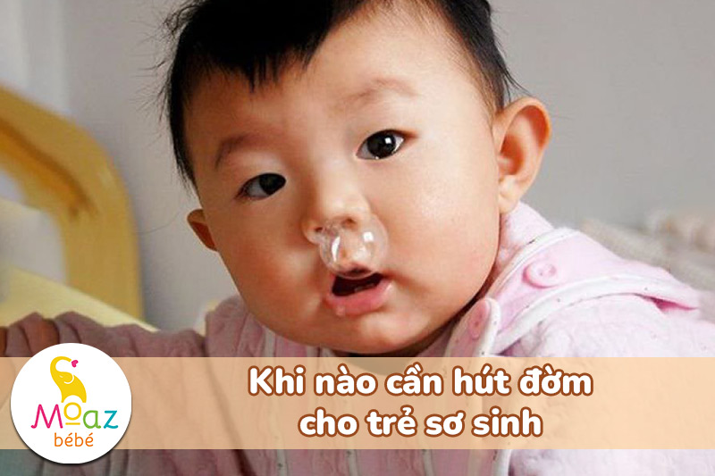 Khi nào cần hút đờm cho trẻ sơ sinh