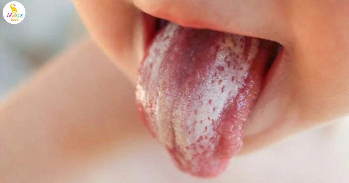 Những loại vi khuẩn thường có trong bình sữa trẻ sơ sinh 3 nhung loai vi khuan thuong co trong binh sua 2