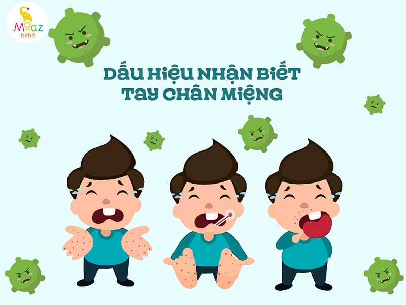 Dấu hiệu nhận biết sớm tay chân miệng