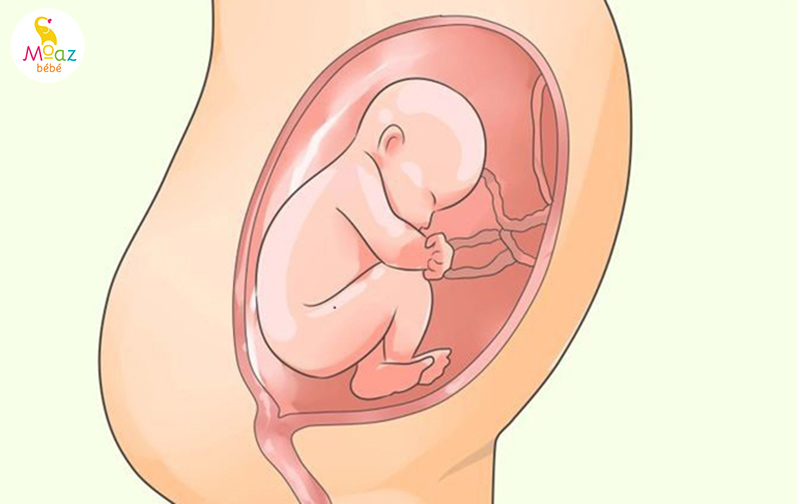 Thế nào là đa ối?