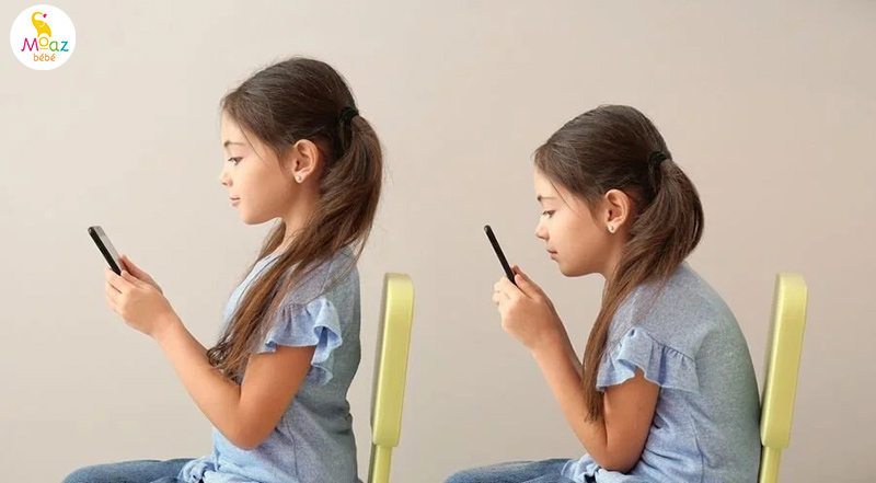Dấu hiệu nhận biết gù lưng ở trẻ em