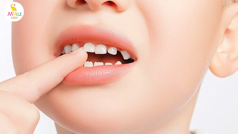 Thứ tự mọc răng của bé theo tháng tuổi mẹ nên biết 3 Phân biệt răng sữa và răng vĩnh viễn