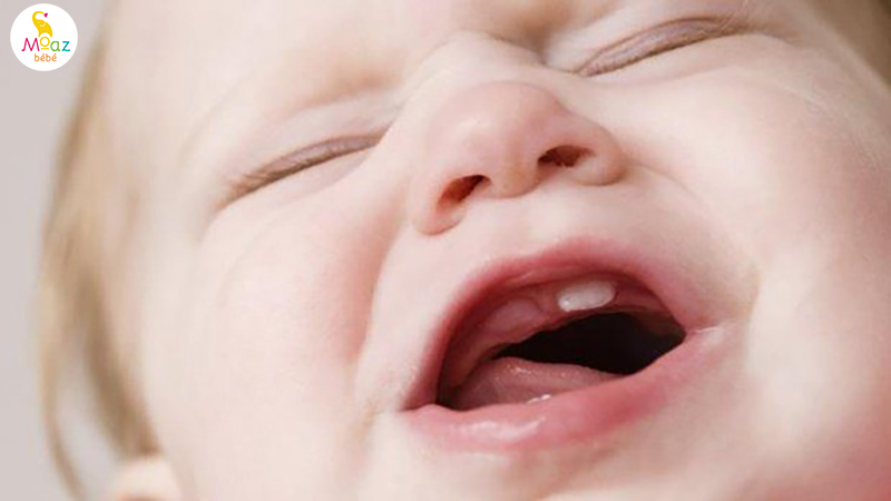Trẻ mọc răng muộn nhất là mấy tháng và những điều cần lưu ý 4 Những nguyên nhân khiến trẻ mọc răng muộn