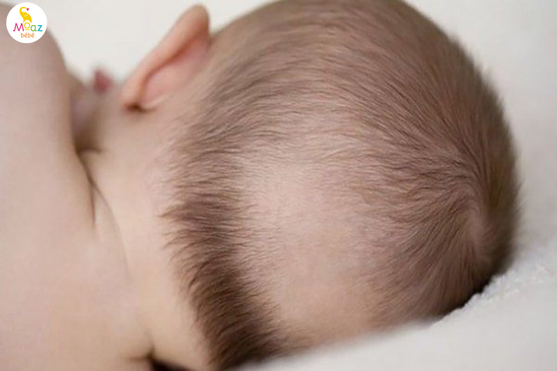 Trẻ sơ sinh ít tóc có sao không? có phải do thiếu chất? 2 trẻ sơ sinh ít tóc có phải do thiếu chất không
